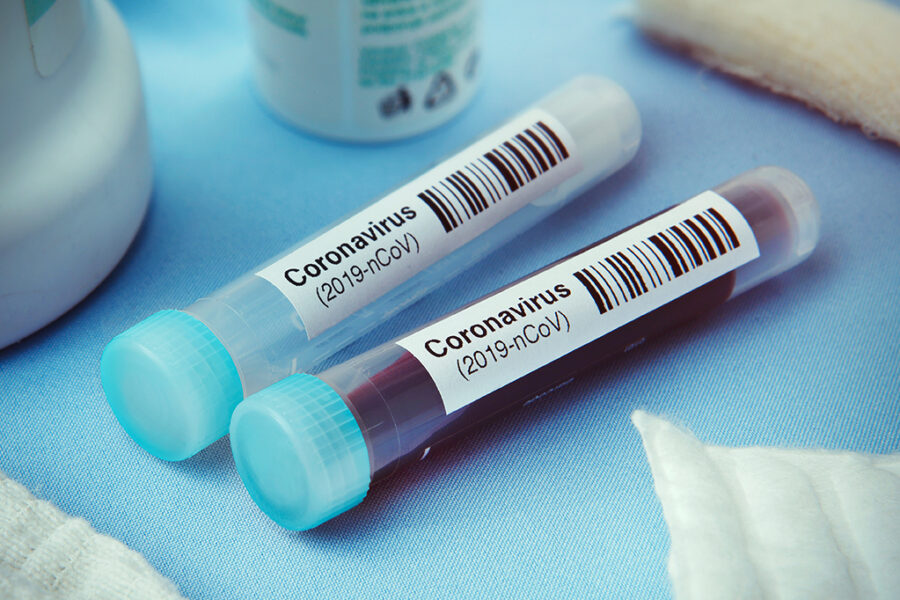 Goiás tem 943.102 casos de Covid-19 e 24.604 mortes