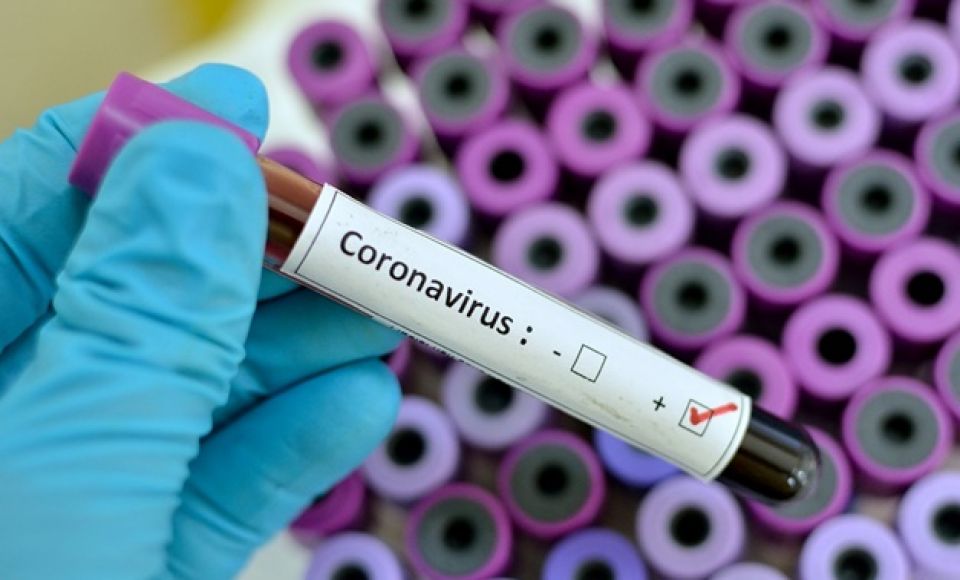 Goiás tem 26.294 mortos e 1.286.311 casos de coronavírus