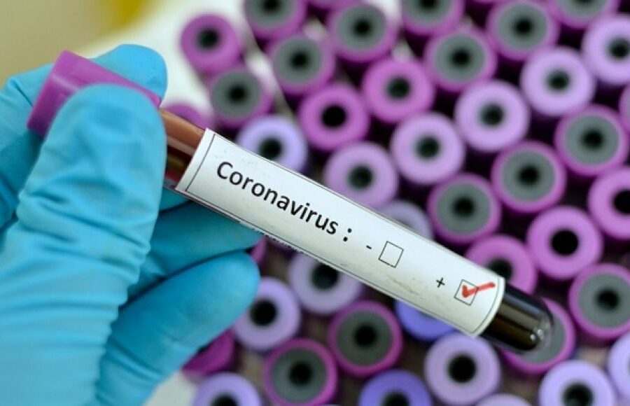 Goiás tem 1.421.469 casos de Covid-19 e 26.737 mortos