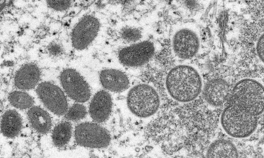 Volta às aulas: saúde estadual busca envolver estudantes na prevenção à Monkeypox