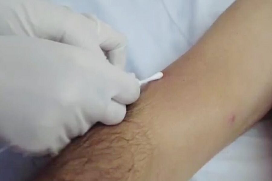 Governo de Goiás realiza “Oficina em Monkeypox” para profissionais de saúde