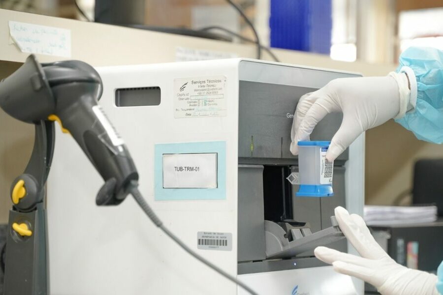 Saúde alerta para importância do diagnóstico e tratamento da tuberculose