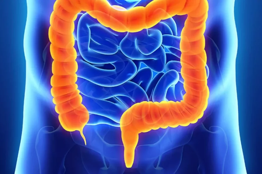 Março Azul faz mutirão de prevenção ao câncer de intestino