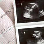 Hospital da Mulher realizará mutirão de ecocardiograma fetal