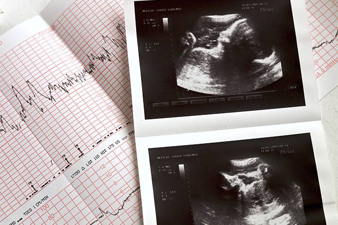 Hospital da Mulher realizará mutirão de ecocardiograma fetal