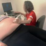 Mutirão de ecocardiogramas fetais do Hemu  realiza 78 exames
