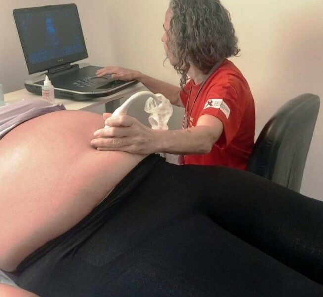 Mutirão de ecocardiogramas fetais do Hemu realiza 78 exames