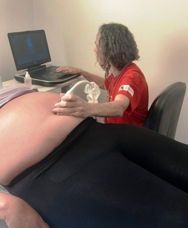 Mutirão de ecocardiogramas fetais do Hemu  realiza 78 exames