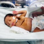 Maternidade estadual oferece redeterapia a prematuros