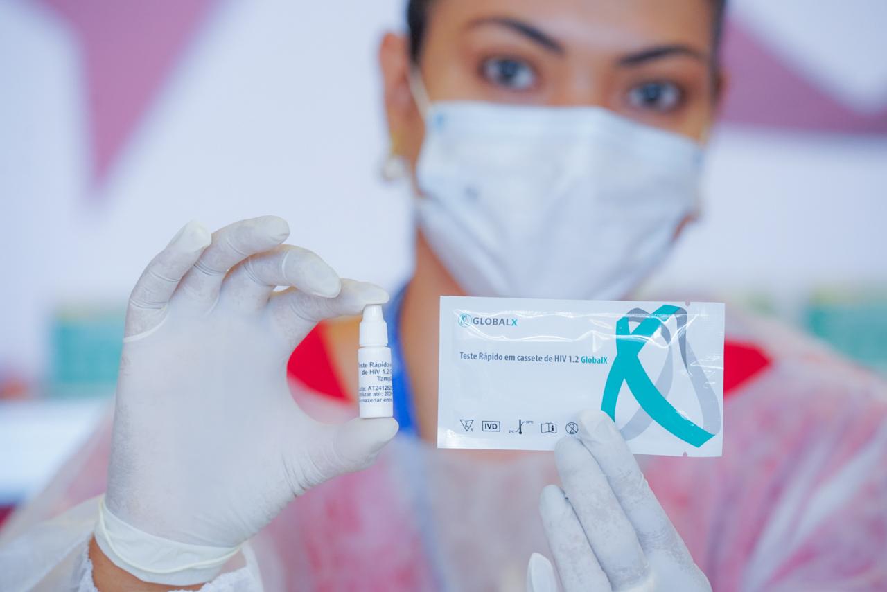 Governo divulga boletim sobre HIV e Aids 2025