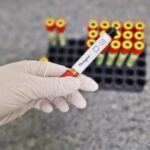 Com as chuvas, hospital alerta para redobrar os cuidados com a dengue