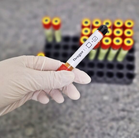 Com as chuvas, hospital alerta para redobrar os cuidados com a dengue