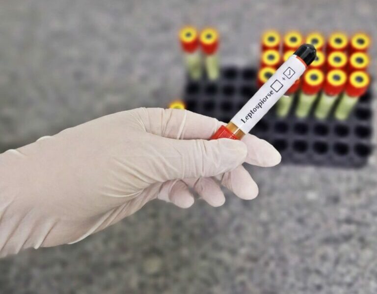 HDT alerta para cuidados essenciais contra a leptospirose no período chuvoso